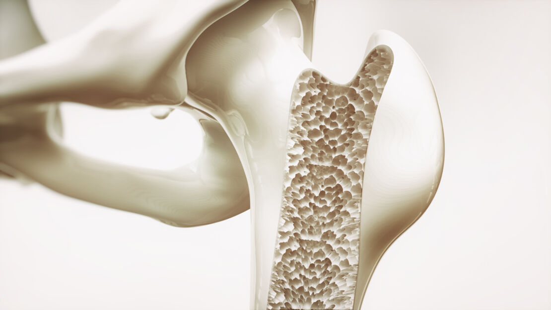 Summary_Bone density_AdobeStock_128396472