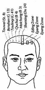 Neuro Acupuncture-zhu
