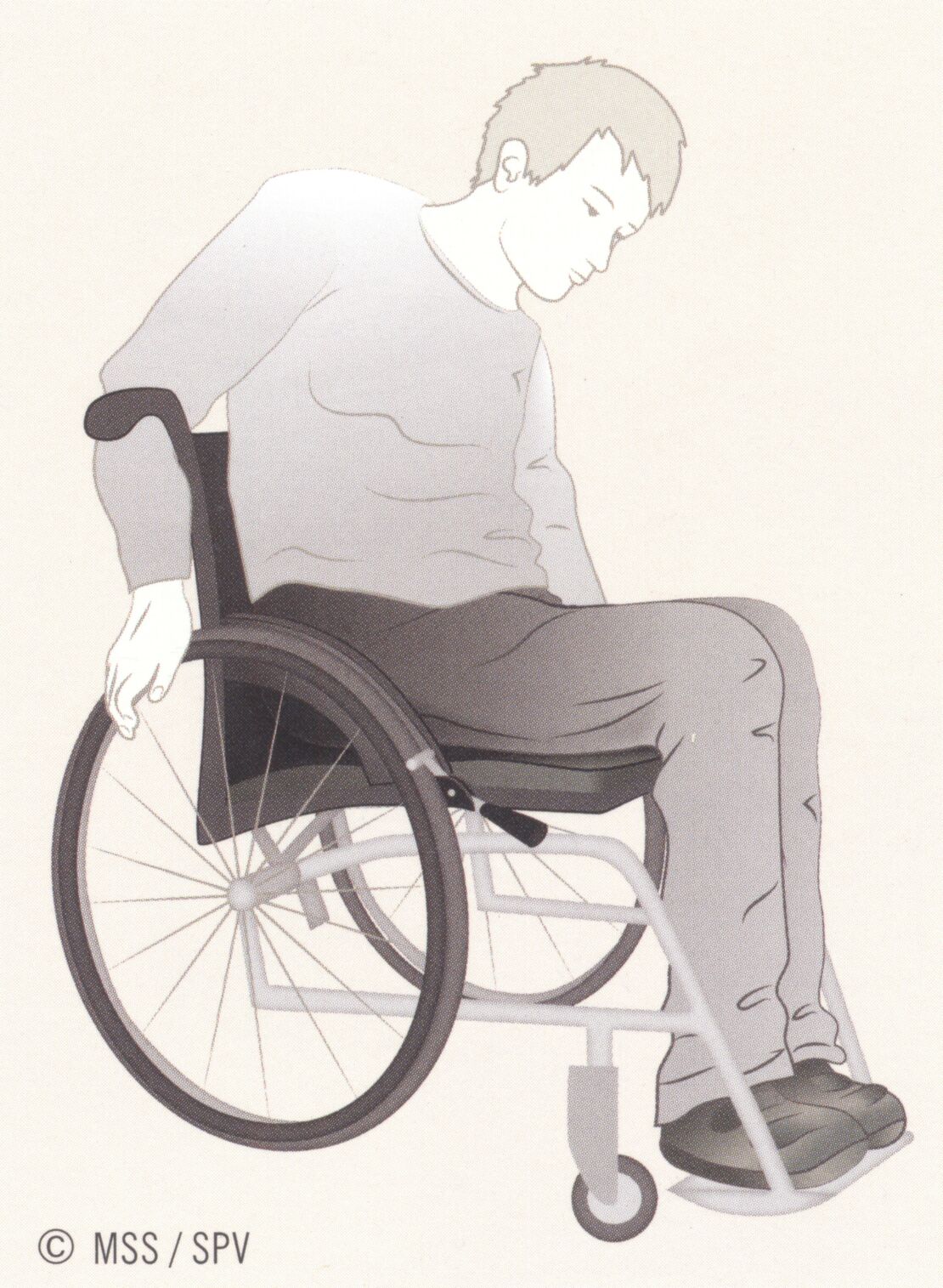 Summary_Decubitus_Picture_48