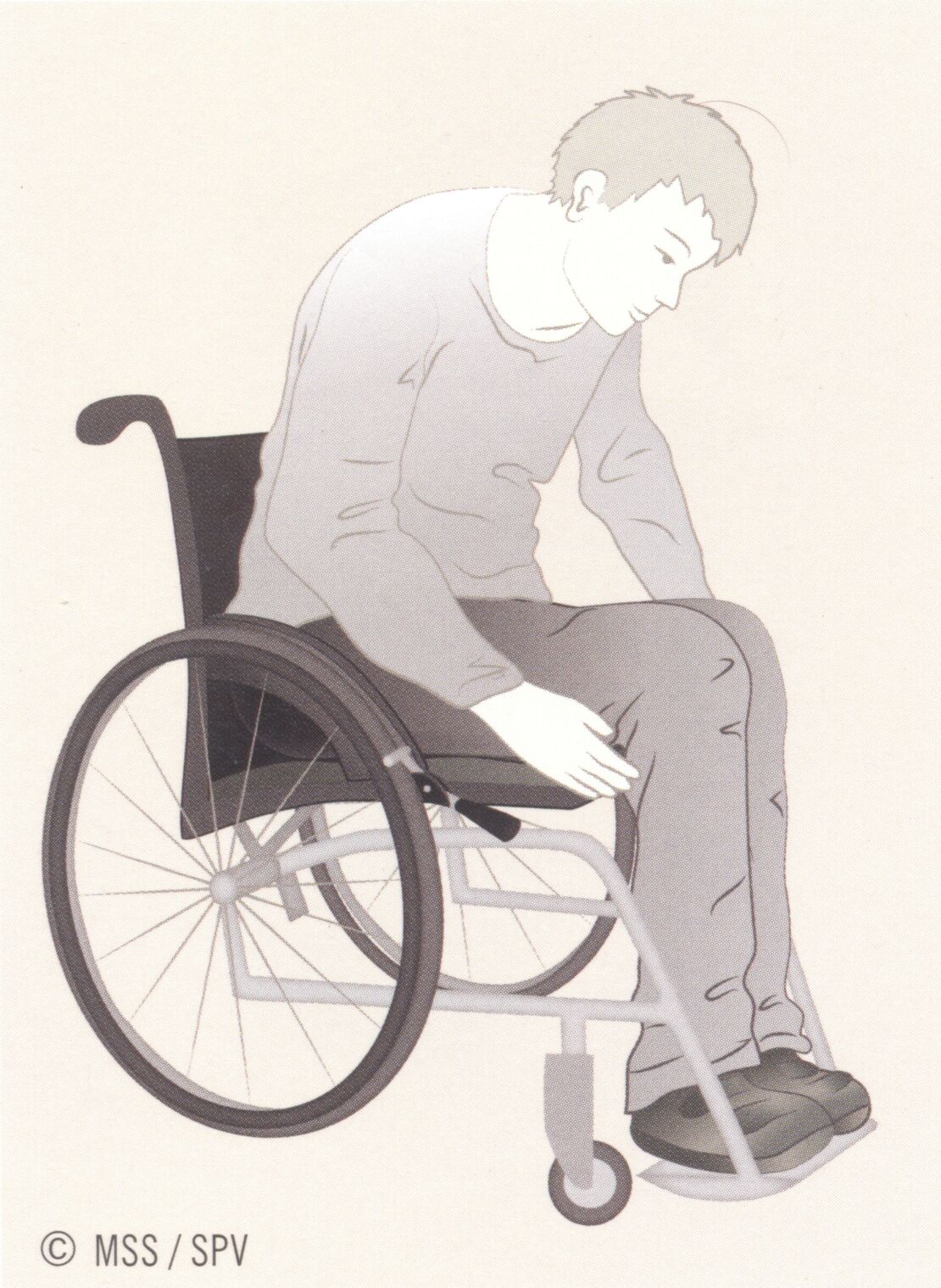 Summary_Decubitus_Picture_47